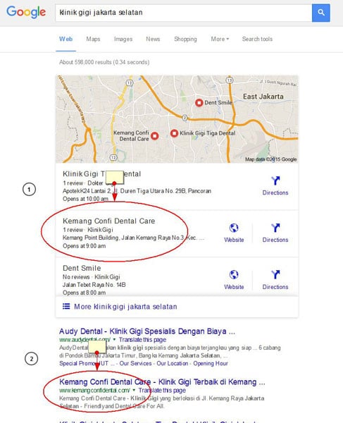 Jasa SEO untuk klinik gigi jakarta - kemangconfidental Jasa SEO untuk klinik gigi jakarta - kemangconfidental
